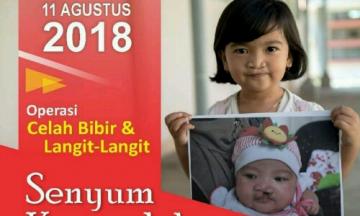 RSU Aisyiyah Padang akan Gelar Operasi Bibir Sumbing Gratis, Ini Jadwalnya