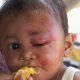 Bocah Ini Jadi Korban Gempa Lombok, ACT : Jangan Menangis lagi Muhammaf Fariq Firdaus