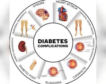 Diabetes Ibu Dari Segala Penyakit, Kenali Penyebab dan Pencegahannya