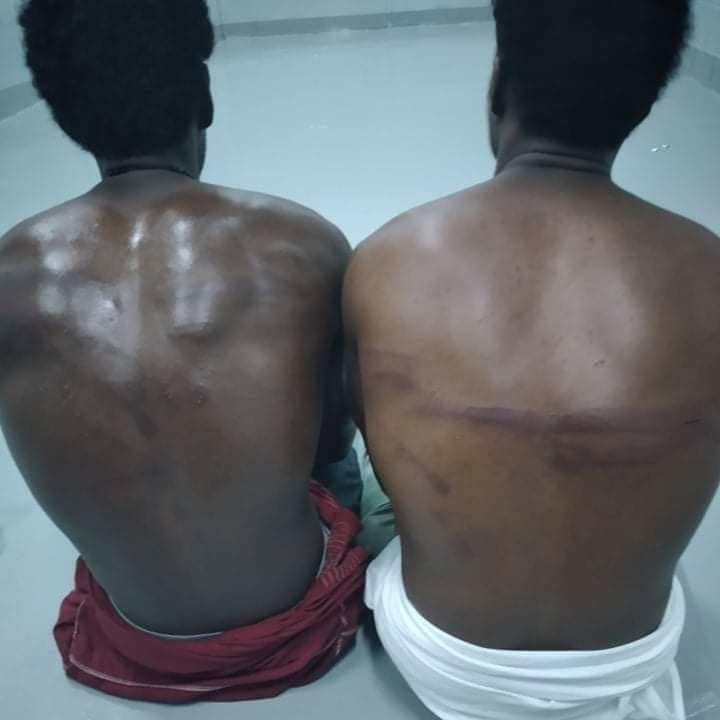 Berdalih Karantina COVID-19, Migran Afrika Dibiarkan 'Membusuk' di Pusat Penahanan Arab Saudi ~ Beritasumbar