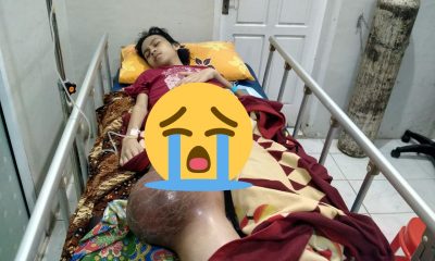 Pasca Operasi Punggung, Lutut Membesar Sebesar Bola Kaki – Beritasumbar.com